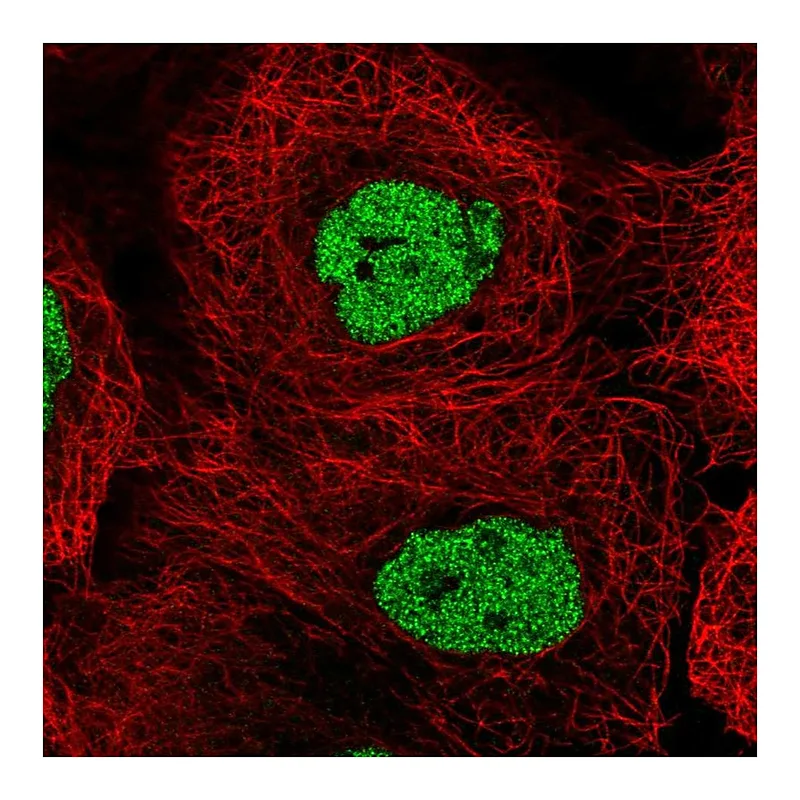 Atlas Antibodies Anti-CSNK2A1 Antibody