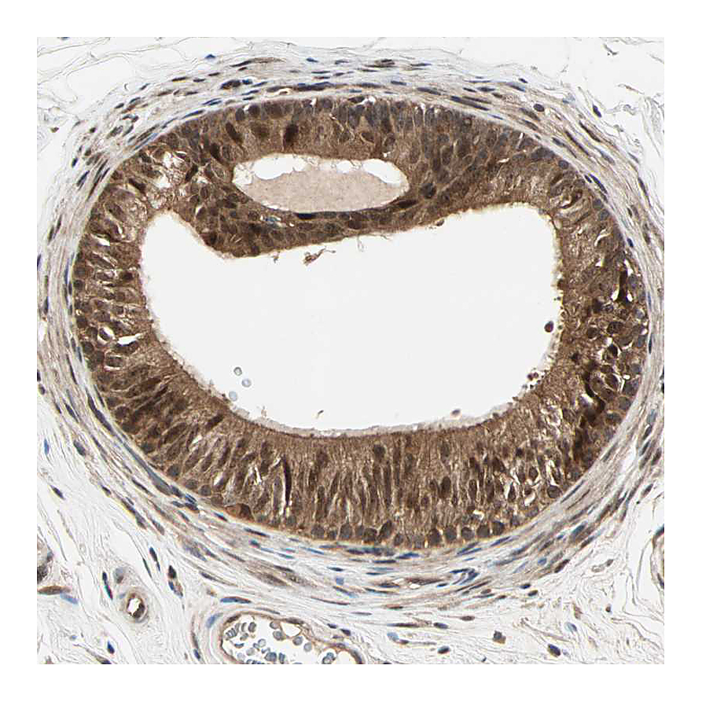 Atlas Antibodies Anti-CSNK2B Antibody