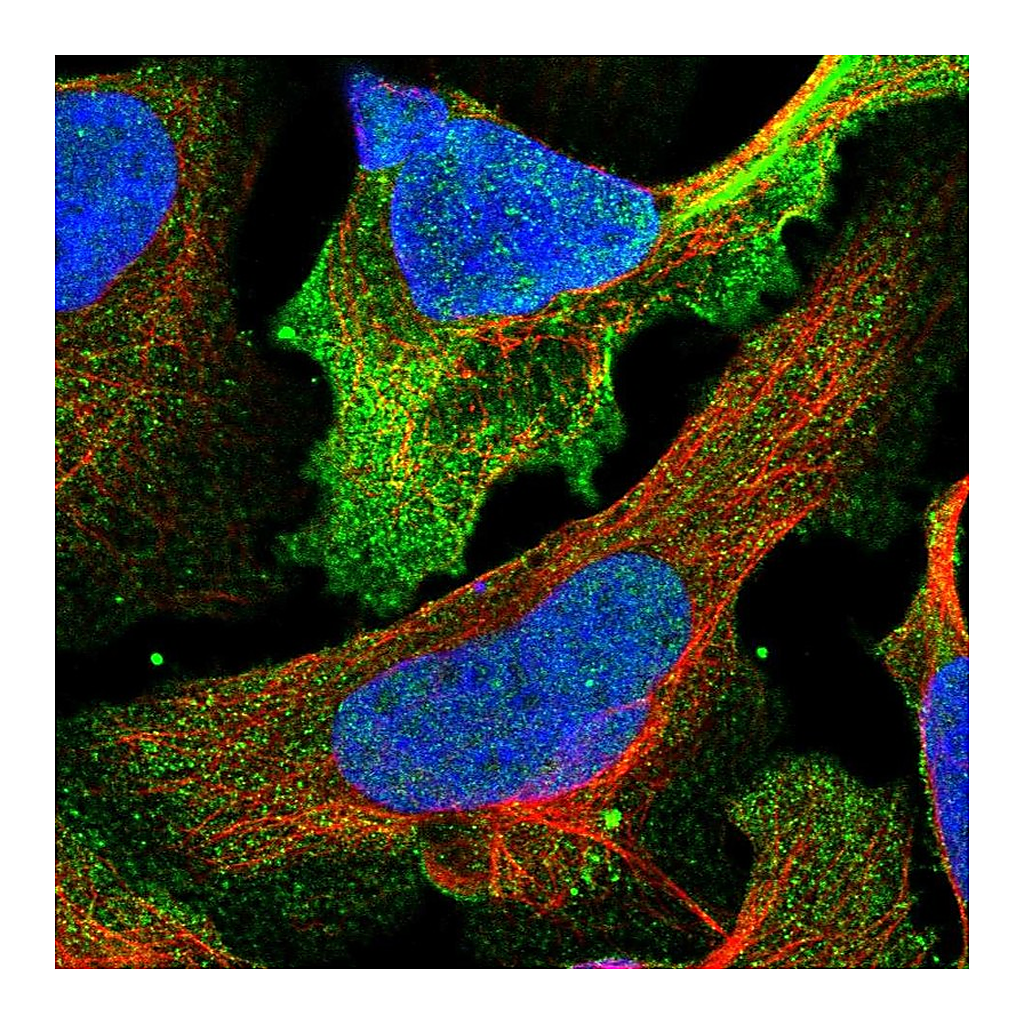Atlas Antibodies Anti-CSPG4 Antibody