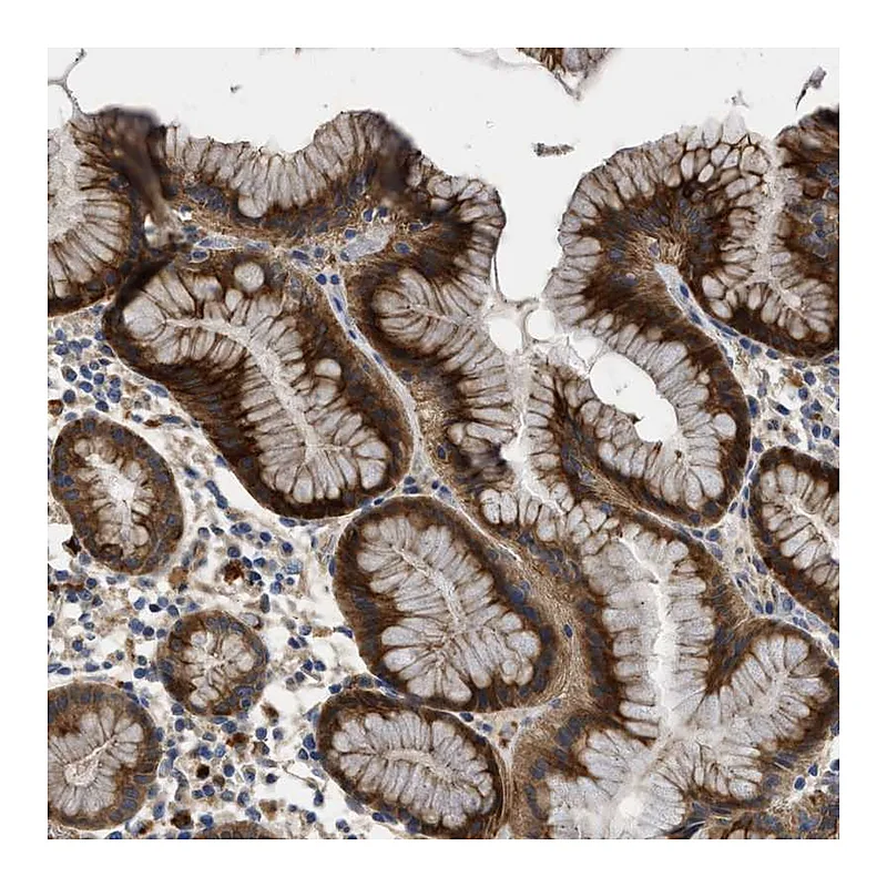 Atlas Antibodies Anti-CSRNP2 Antibody