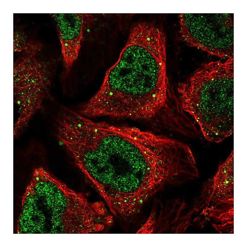 Atlas Antibodies Anti-CSRNP1 Antibody