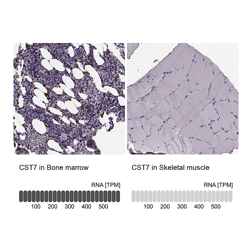Atlas Antibodies Anti-CST7 Antibody
