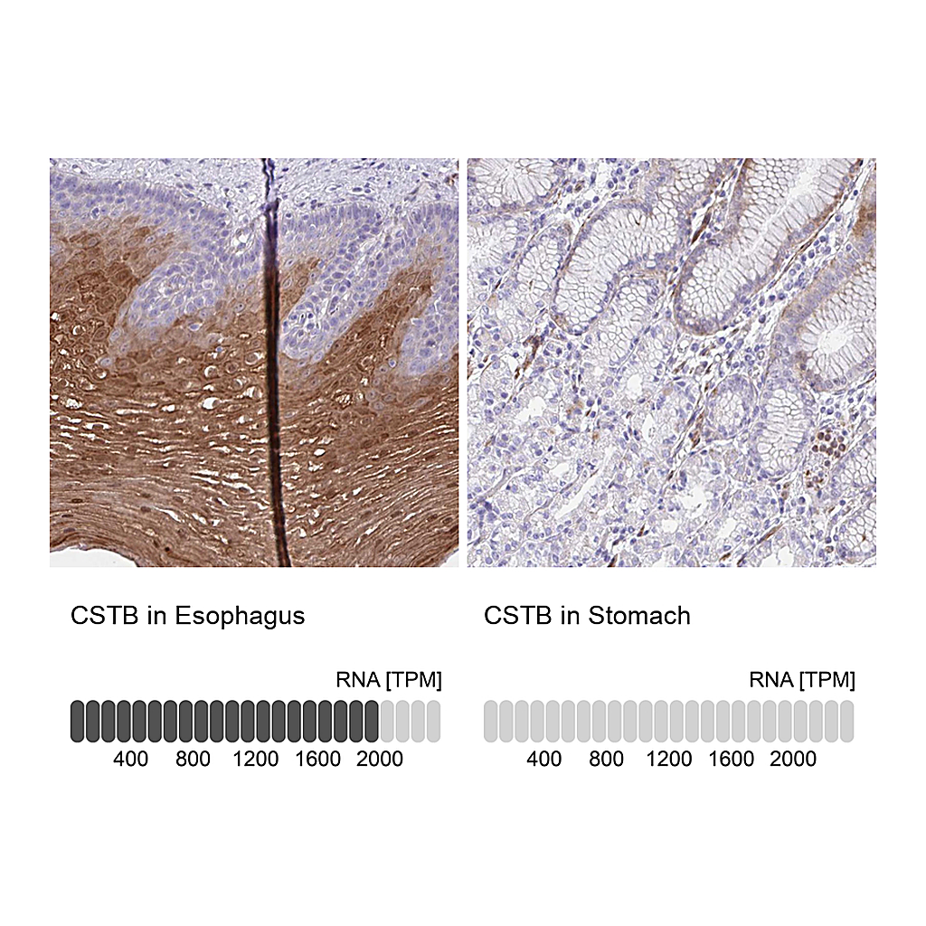Atlas Antibodies Anti-CSTB Antibody