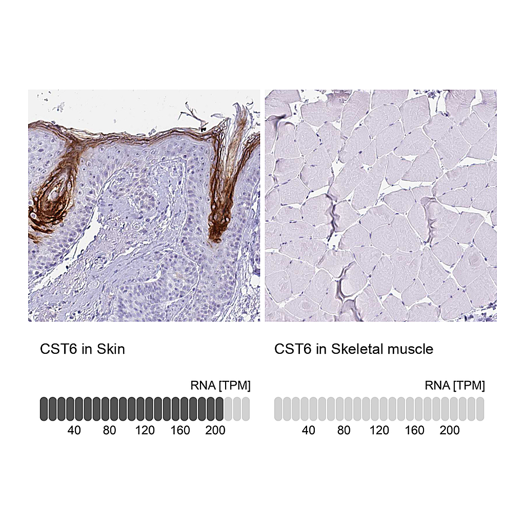 Atlas Antibodies Anti-CST6 Antibody