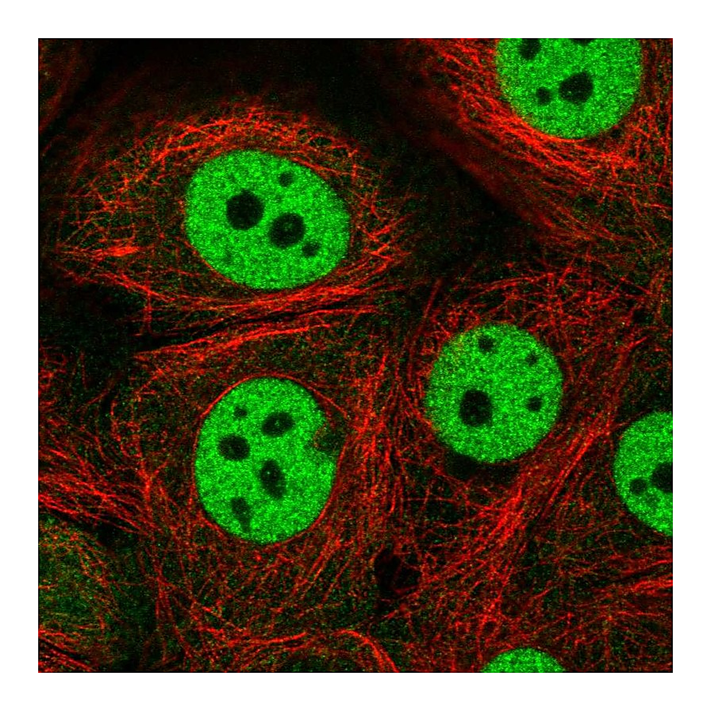 Atlas Antibodies Anti-CSTF1 Antibody