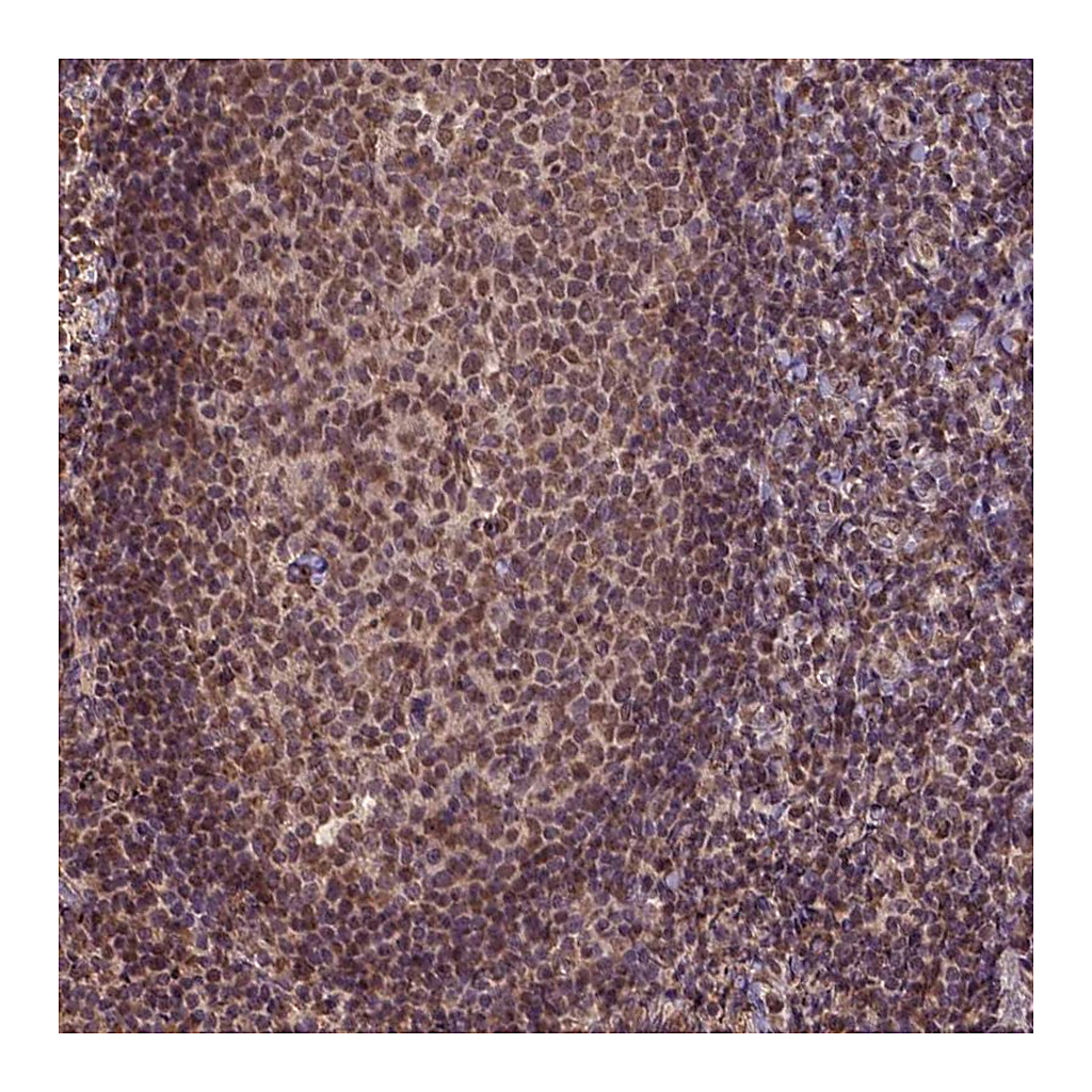 Atlas Antibodies Anti-CSTF2T Antibody