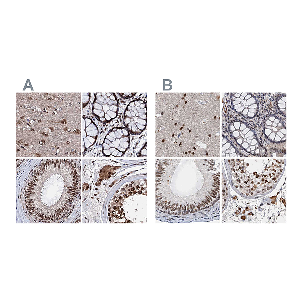 Atlas Antibodies Anti-CSTF3 Antibody