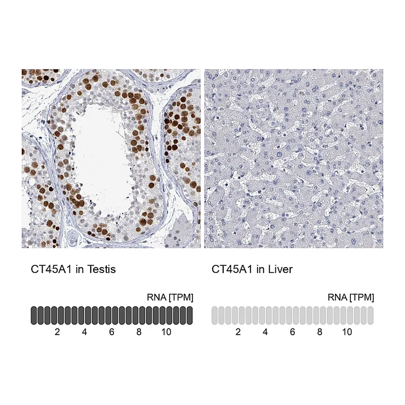 Atlas Antibodies Anti-CT45A1 Antibody