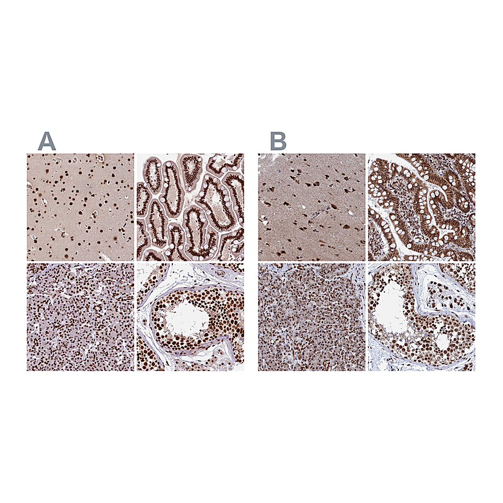 Atlas Antibodies Anti-CTB-50L17.10 Antibody
