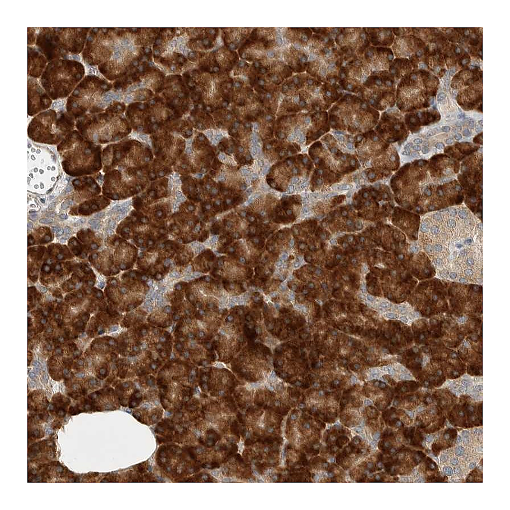 Atlas Antibodies Anti-CTBP2 Antibody