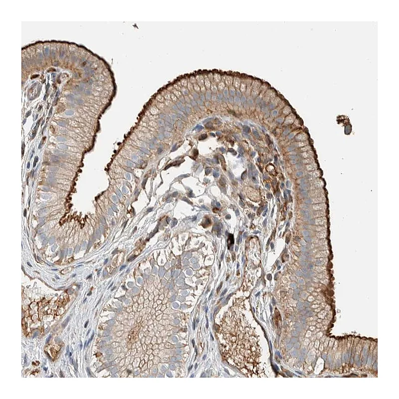 Atlas Antibodies Anti-CTBP2 Antibody
