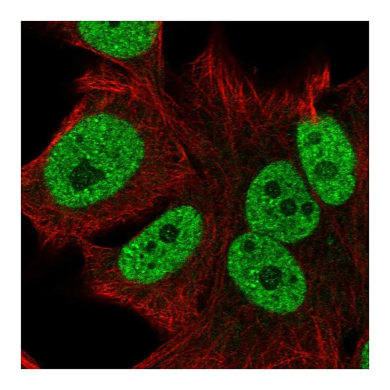 Atlas Antibodies Anti-CTC-534A2.2 Antibody
