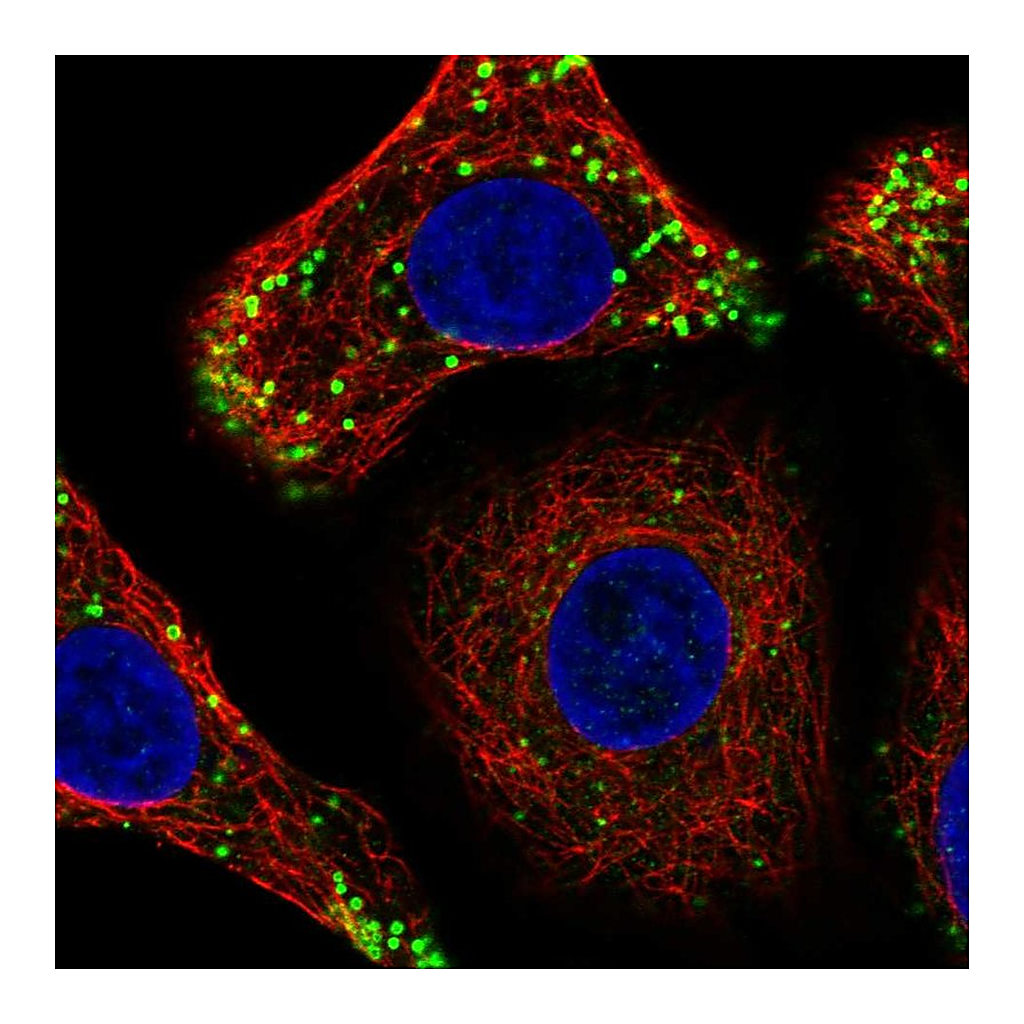 Atlas Antibodies Anti-CTDNEP1 Antibody