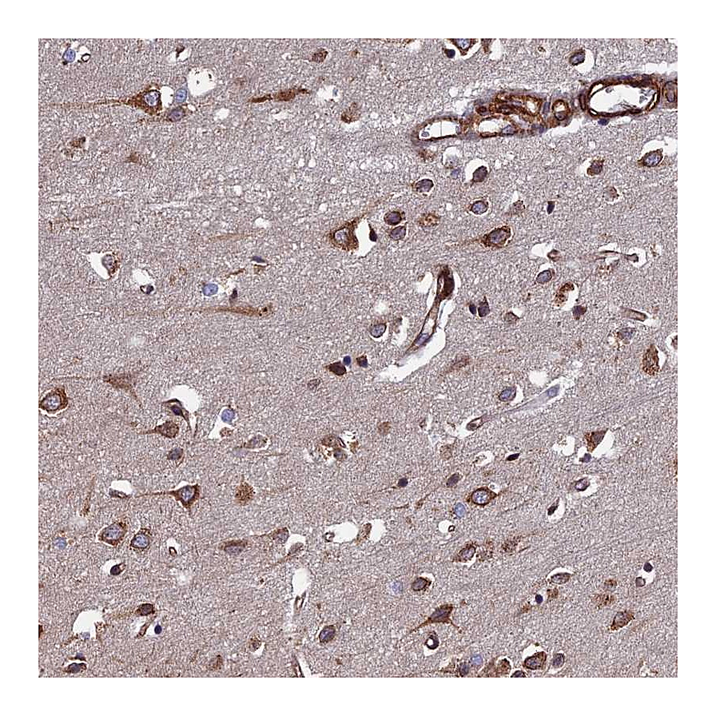 Atlas Antibodies Anti-CTDP1 Antibody