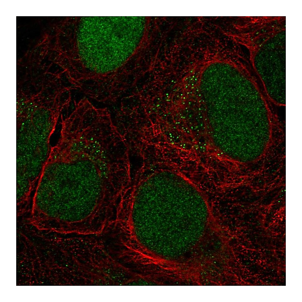 Atlas Antibodies Anti-CTDP1 Antibody