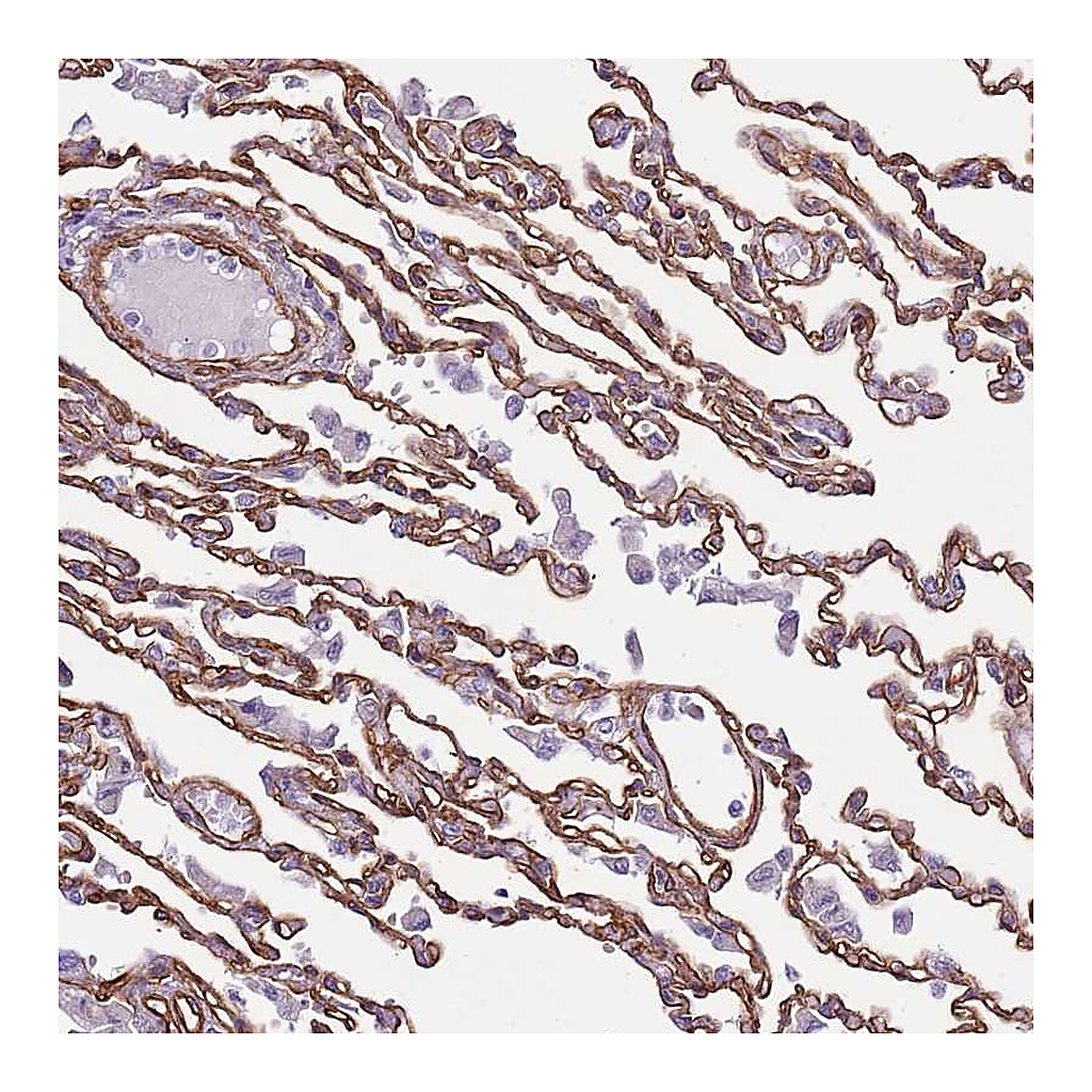 Atlas Antibodies Anti-CTDSPL Antibody