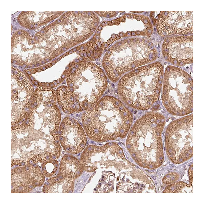 Atlas Antibodies Anti-CTNNA1 Antibody