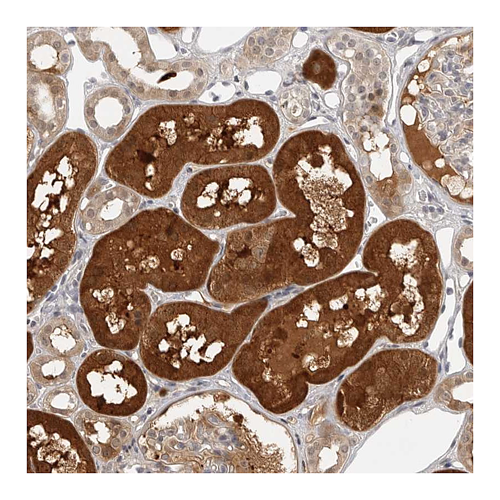 Atlas Antibodies Anti-CTIF Antibody