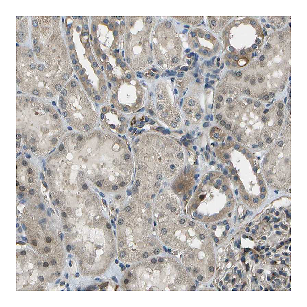 Atlas Antibodies Anti-CTIF Antibody