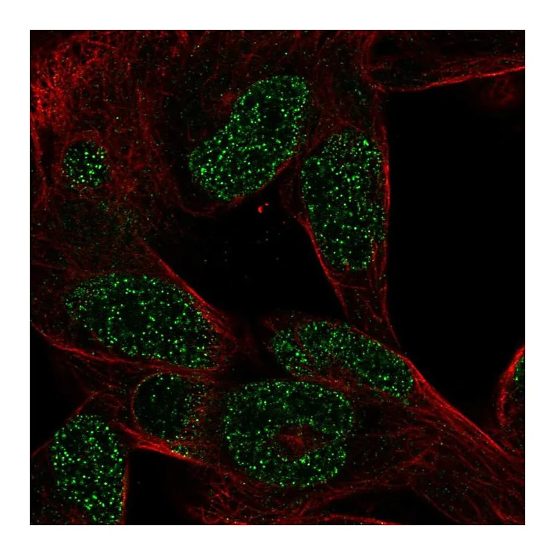 Atlas Antibodies Anti-CTHRC1 Antibody