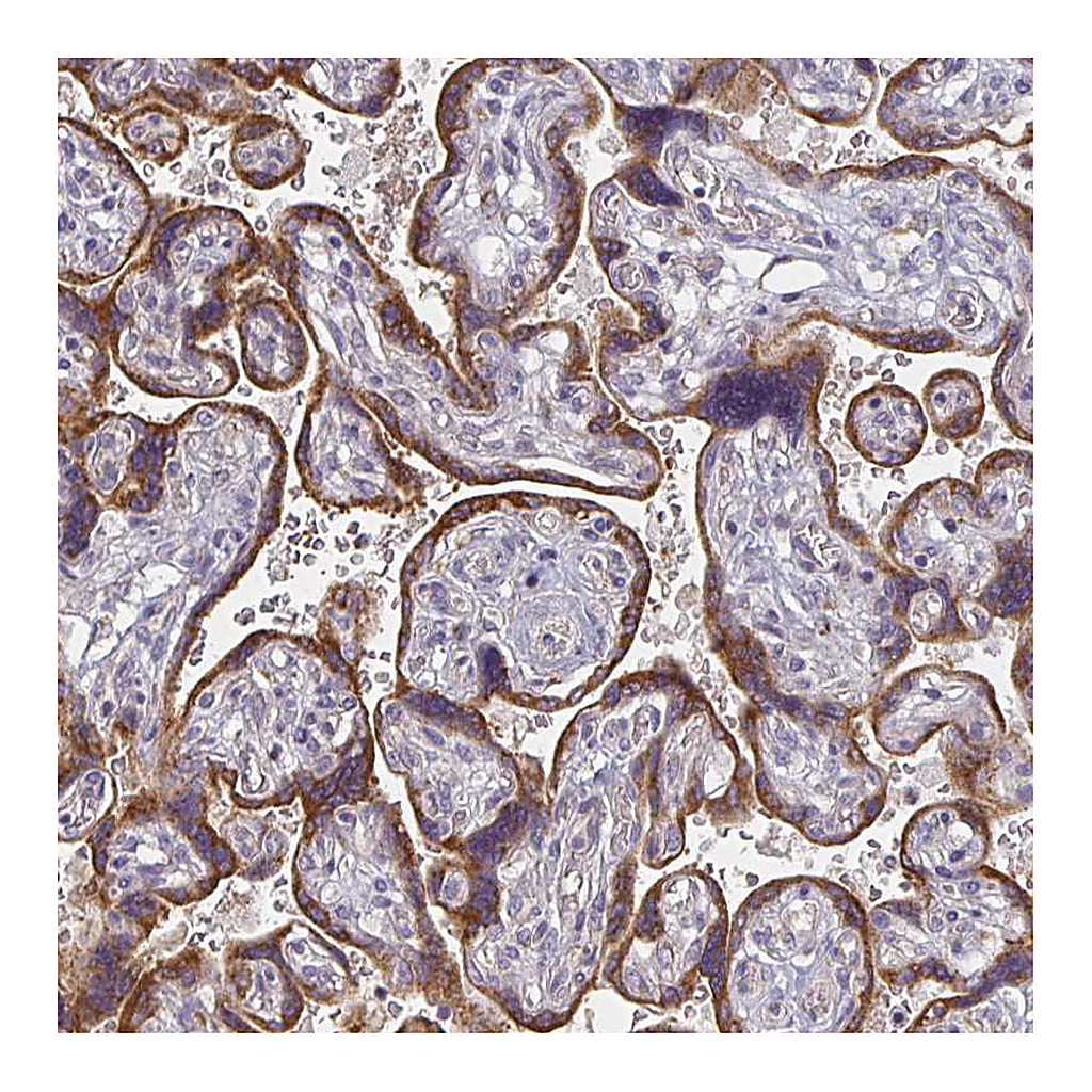 Atlas Antibodies Anti-CTHRC1 Antibody