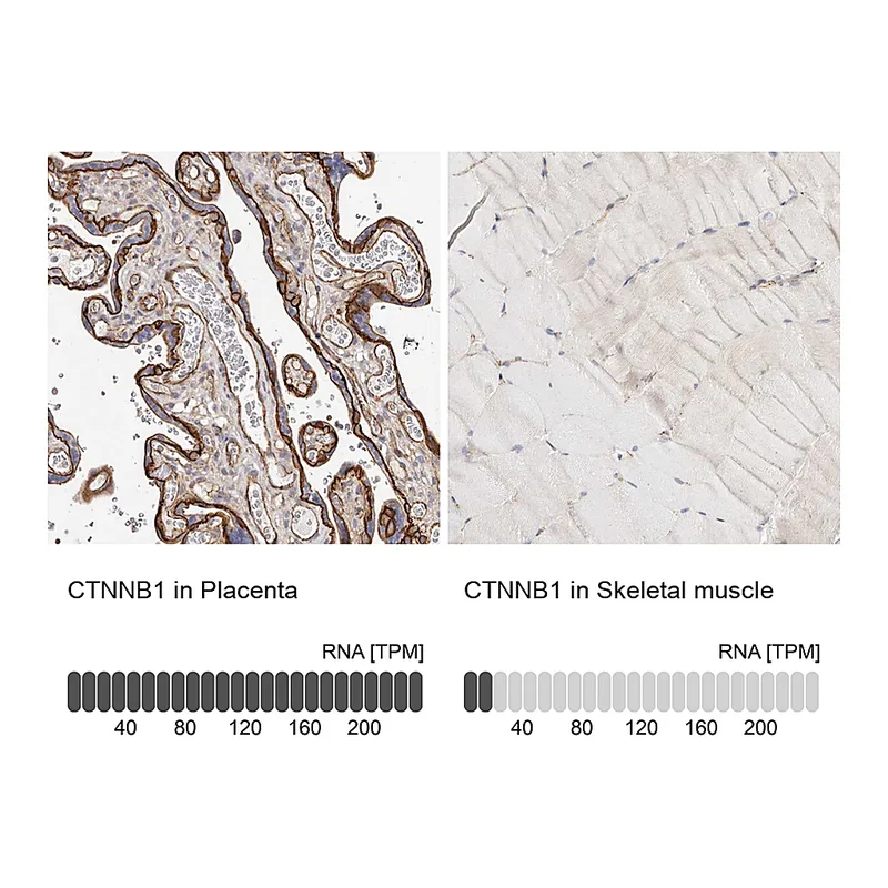 Atlas Antibodies Anti-CTNNB1 Antibody