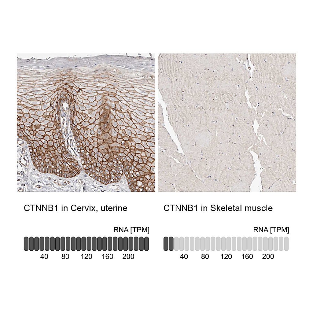 Atlas Antibodies Anti-CTNNB1 Antibody