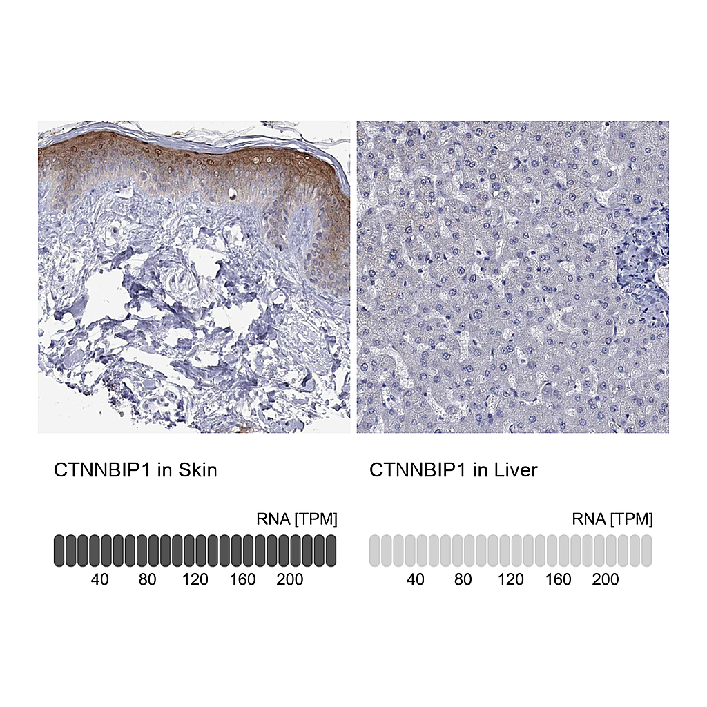 Atlas Antibodies Anti-CTNNBIP1 Antibody