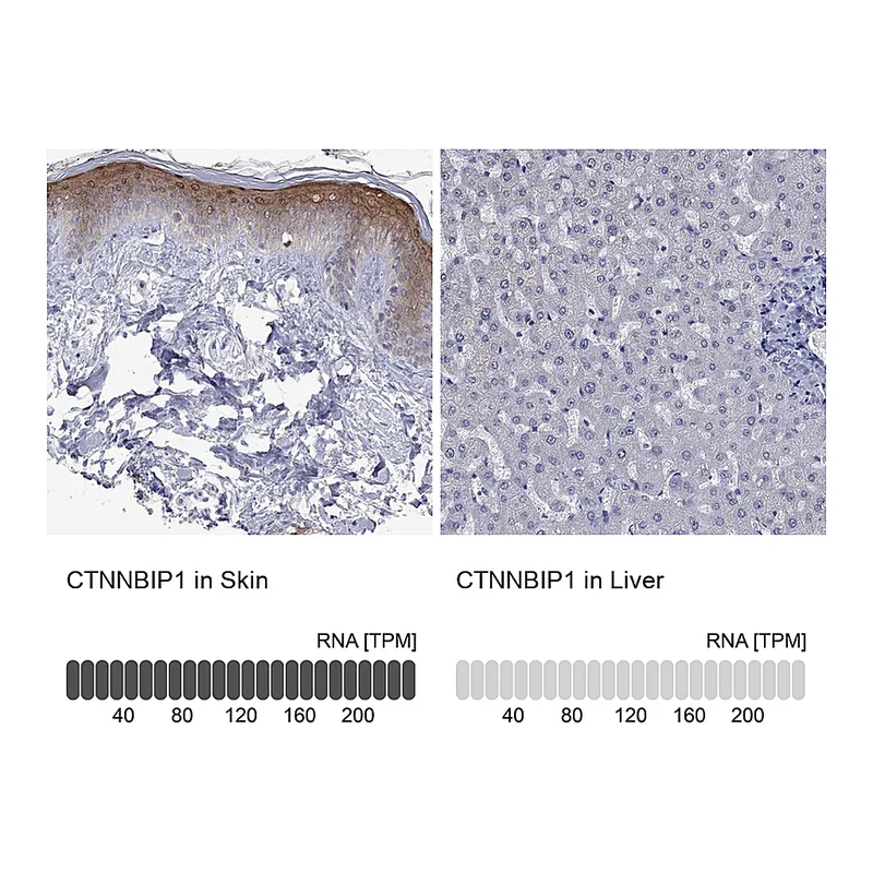 Atlas Antibodies Anti-CTNNBIP1 Antibody