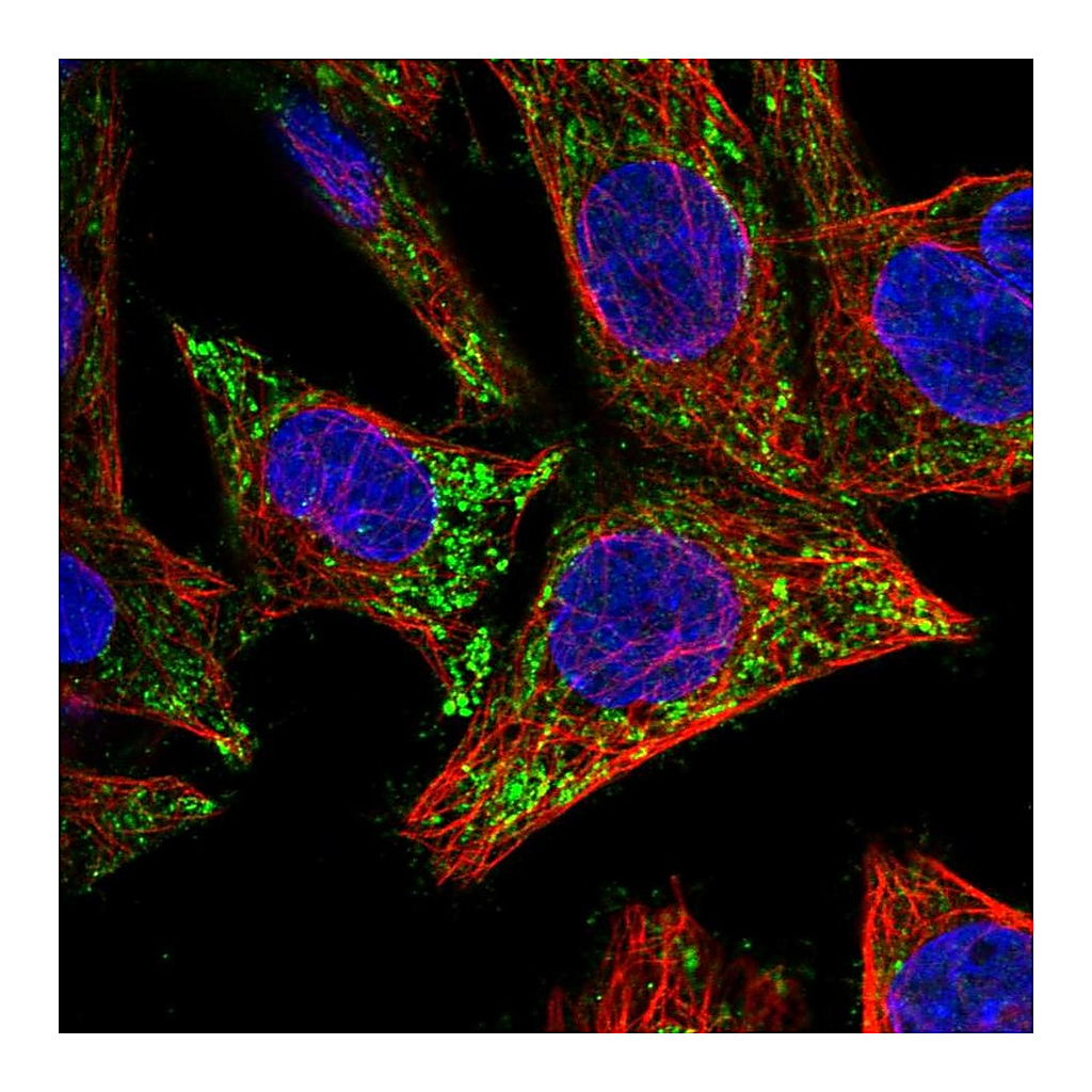 Atlas Antibodies Anti-CTNNBIP1 Antibody