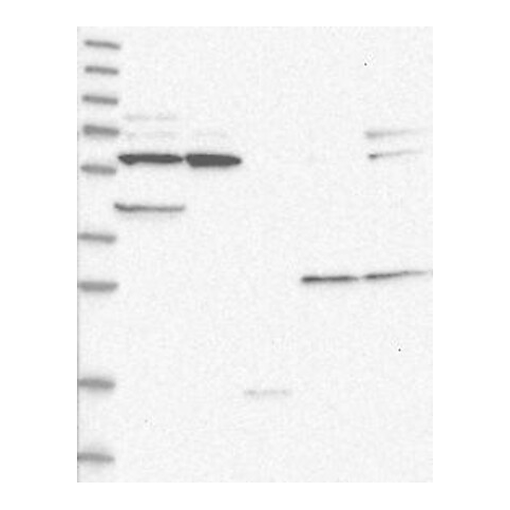 Atlas Antibodies Anti-CTNNBL1 Antibody