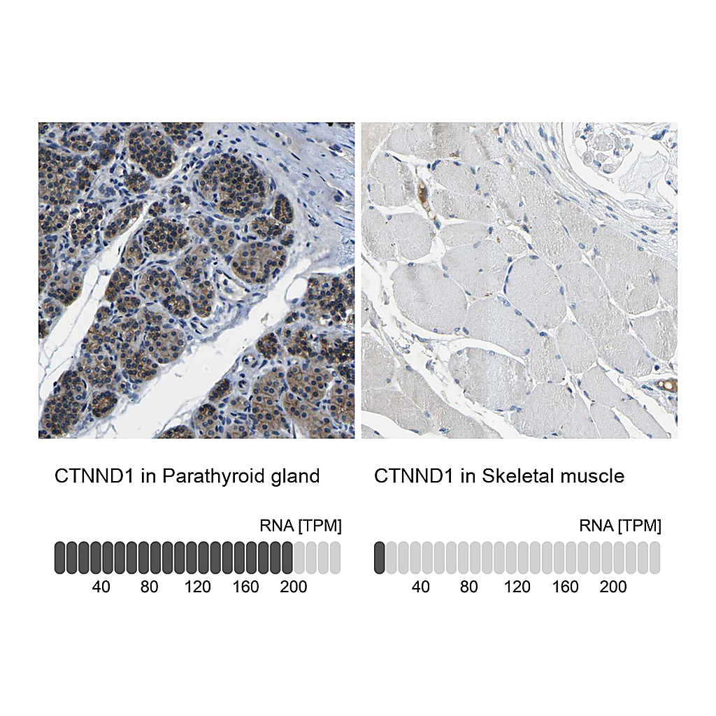 Atlas Antibodies Anti-CTNND1 Antibody