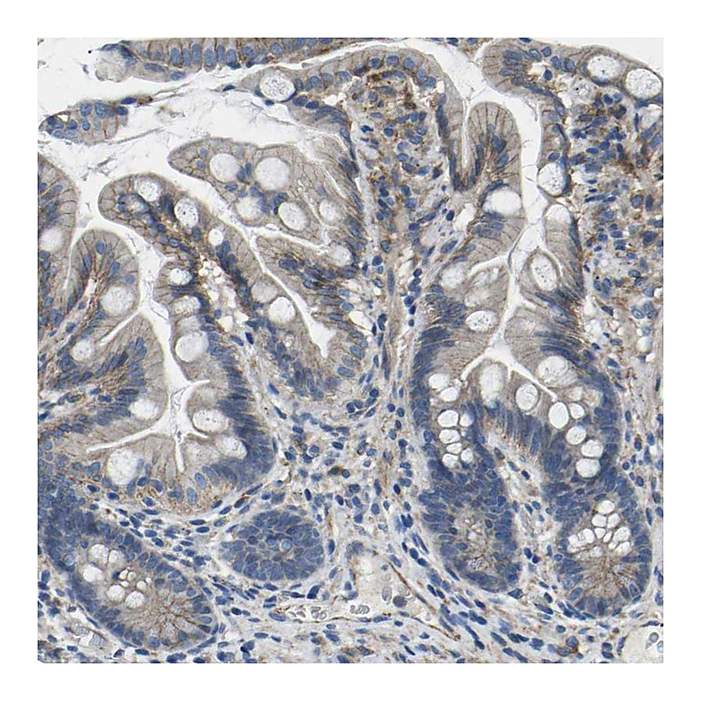 Atlas Antibodies Anti-CTNND1 Antibody