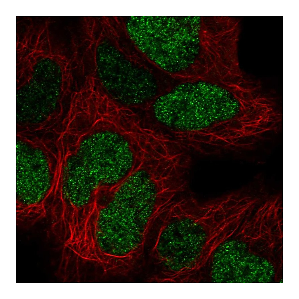 Atlas Antibodies Anti-CTR9 Antibody