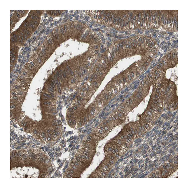 Atlas Antibodies Anti-CTPS2 Antibody