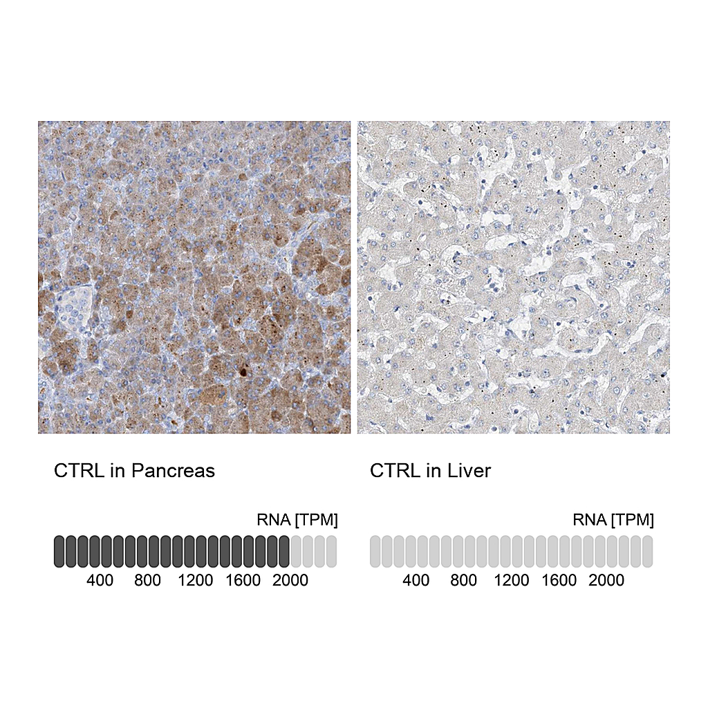 Atlas Antibodies Anti-CTRL Antibody