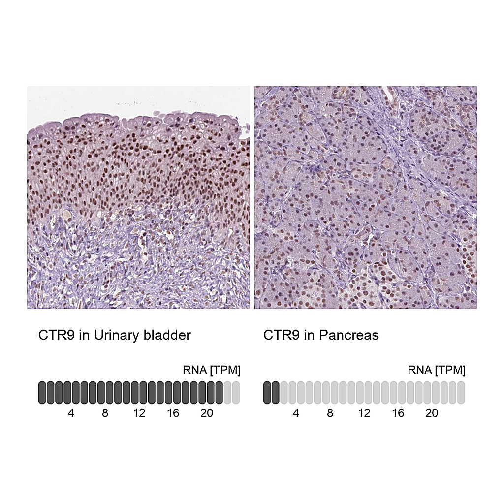 Atlas Antibodies Anti-CTR9 Antibody