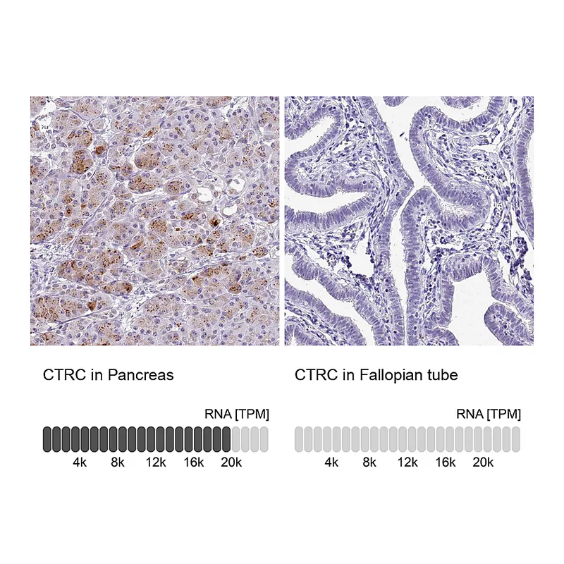 Atlas Antibodies Anti-CTRC Antibody