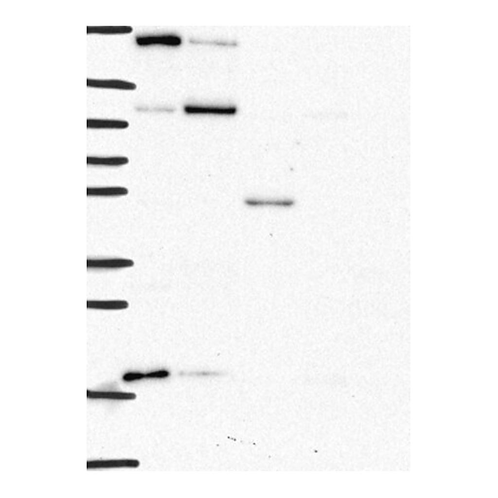 Atlas Antibodies Anti-CTSA Antibody