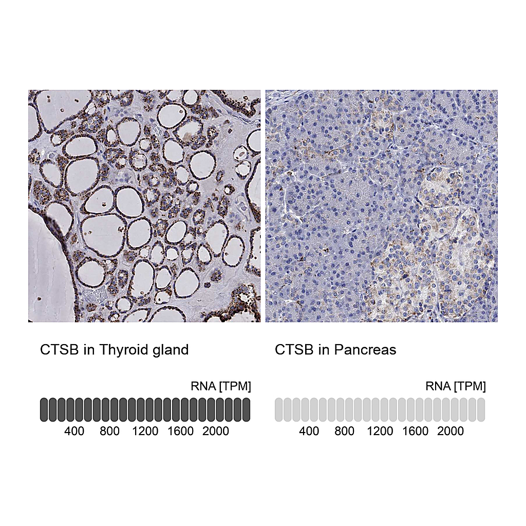 Atlas Antibodies Anti-CTSB Antibody