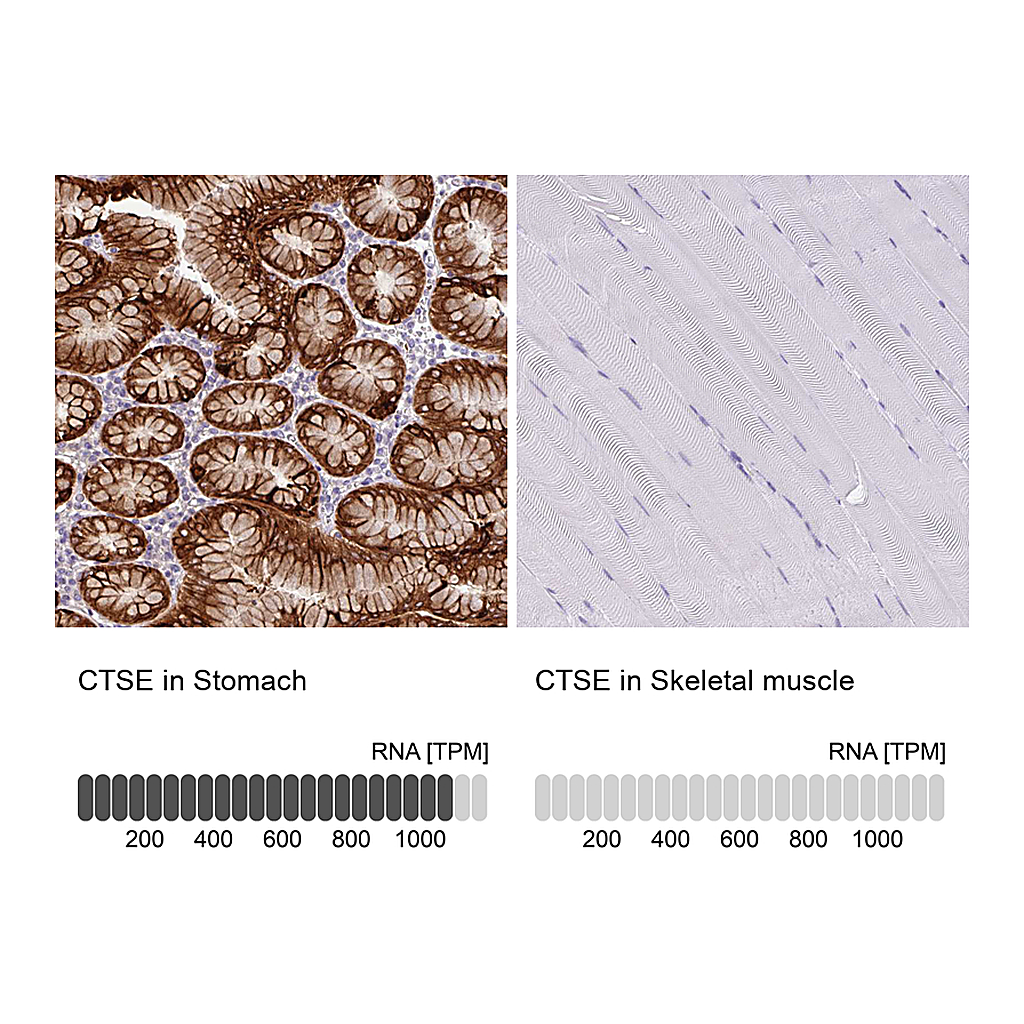 Atlas Antibodies Anti-CTSE Antibody