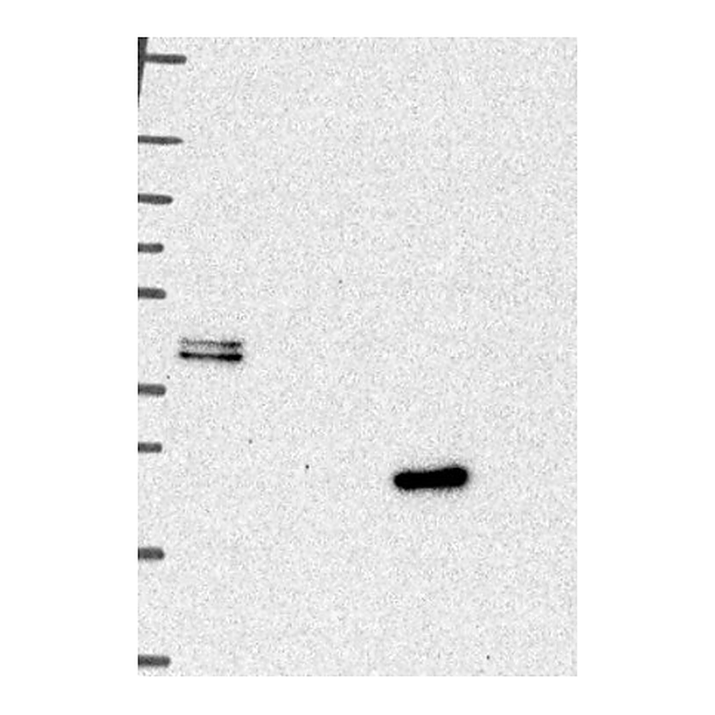 Atlas Antibodies Anti-CTSL Antibody