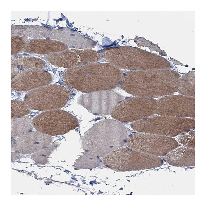 Atlas Antibodies Anti-CTU2 Antibody