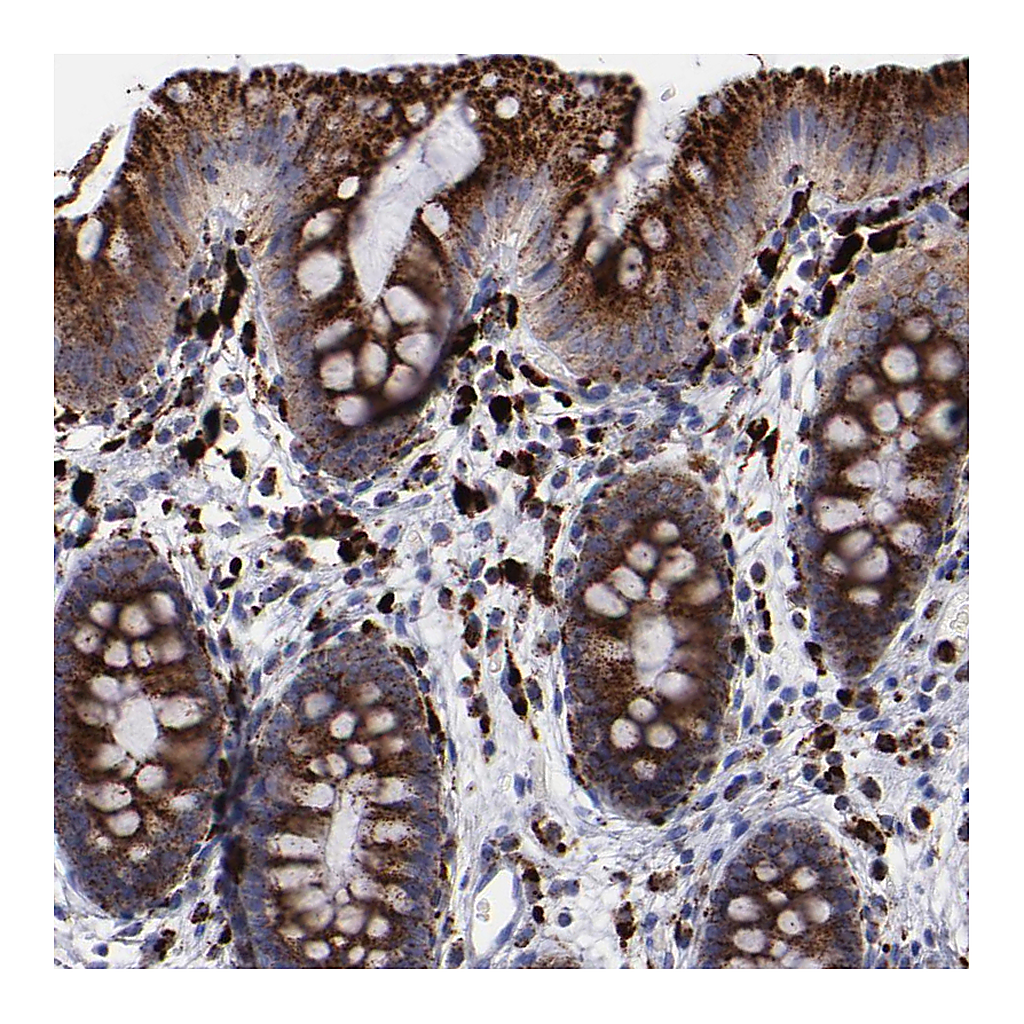 Atlas Antibodies Anti-CTSS Antibody