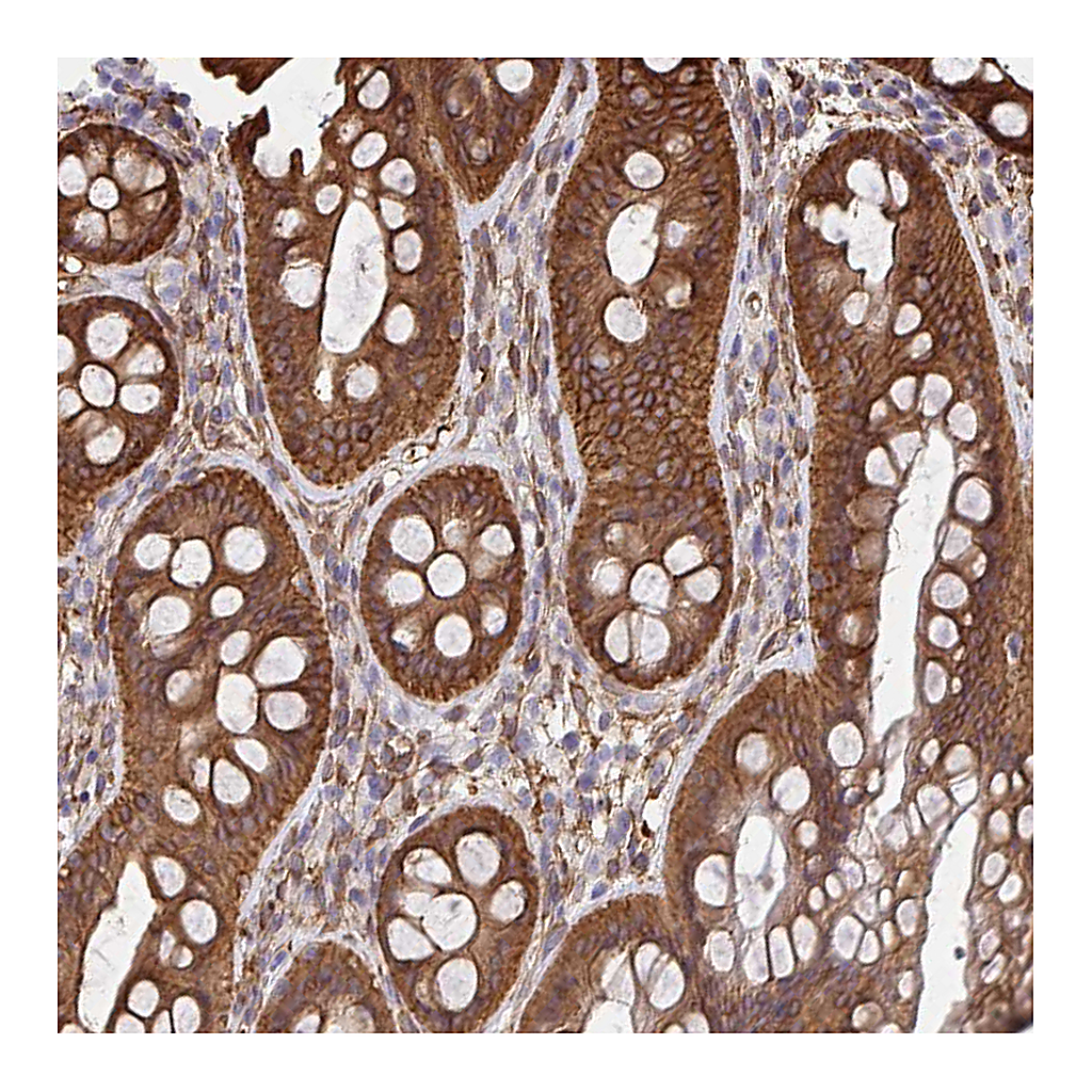Atlas Antibodies Anti-CTTN Antibody