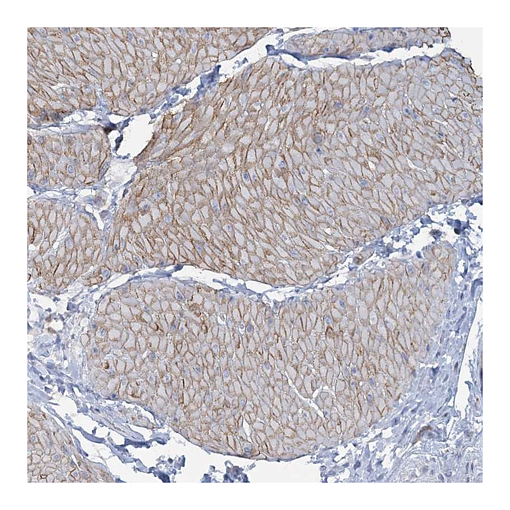 Atlas Antibodies Anti-CUEDC2 Antibody