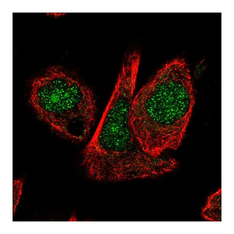 Atlas Antibodies Anti-CUL1 Antibody