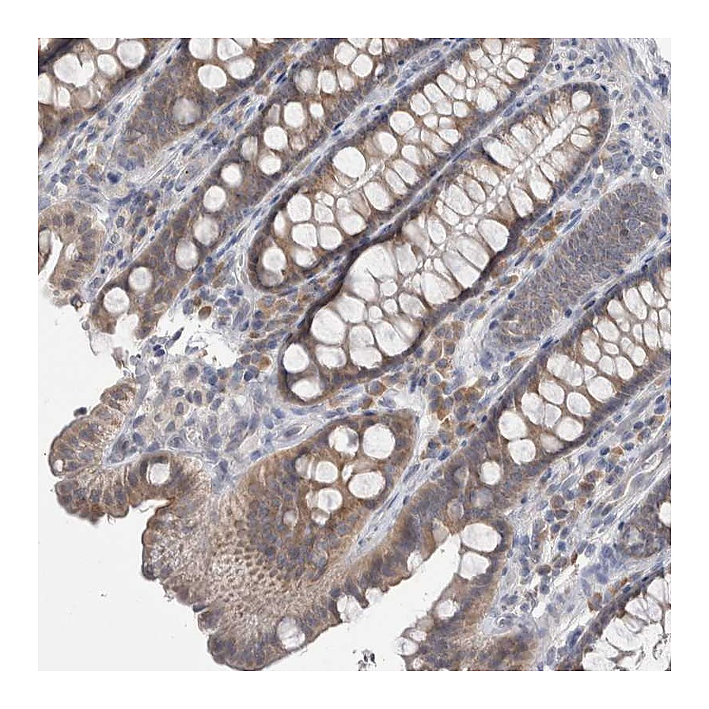Atlas Antibodies Anti-CUL2 Antibody