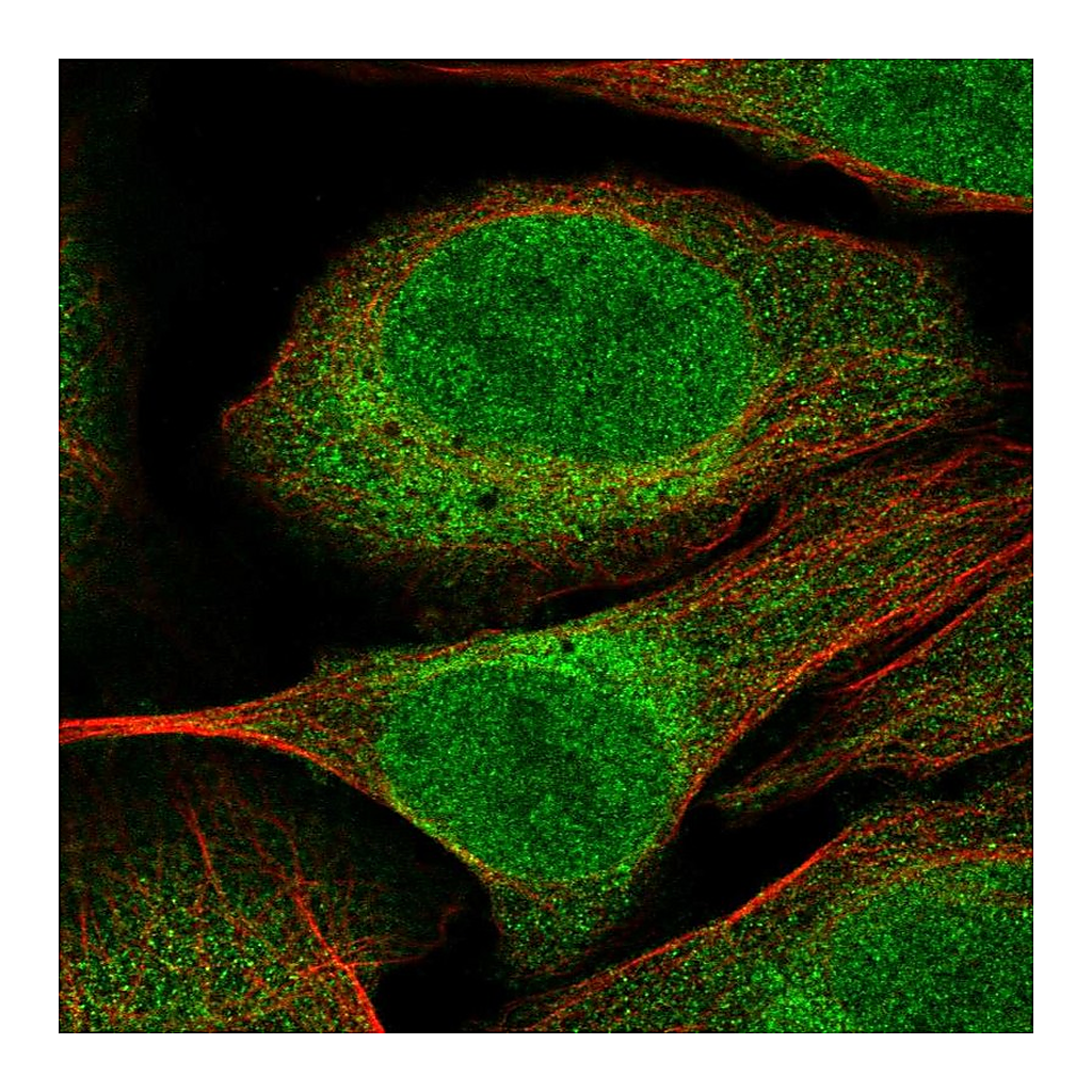 Atlas Antibodies Anti-CUEDC2 Antibody