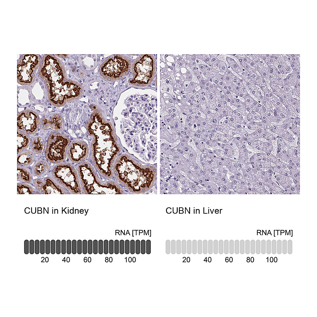Atlas Antibodies Anti-CUBN Antibody